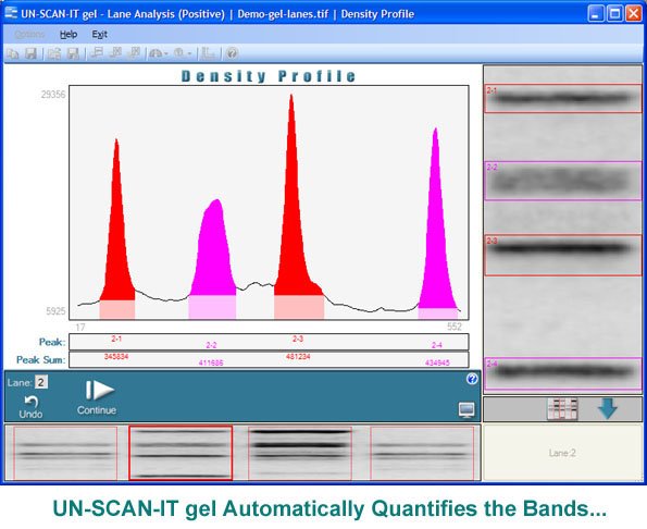 Quantify the Gel Bands