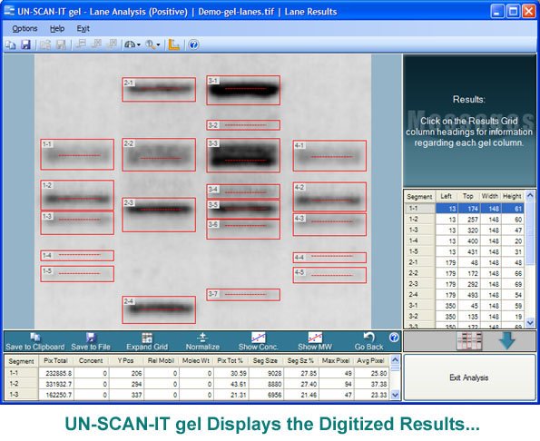 Gel Analysis Results