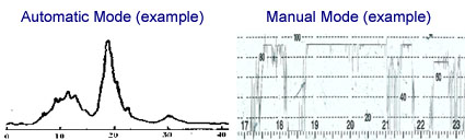 Graph Image 4