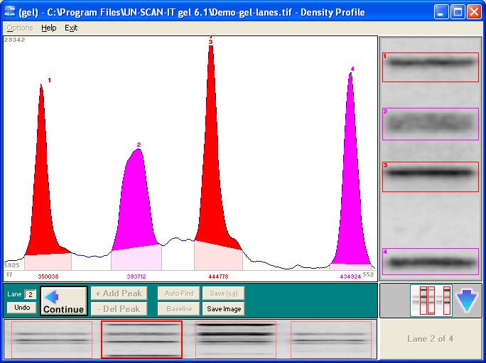 Figure 3. Screen image showing the density profile for a scanned gel image.