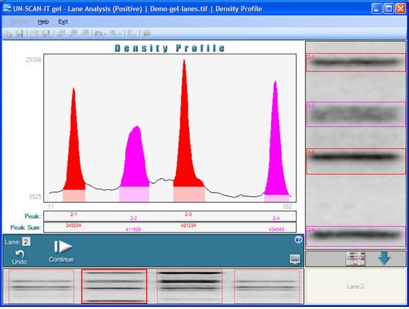 Electrophoresis Densitometry Density Profile