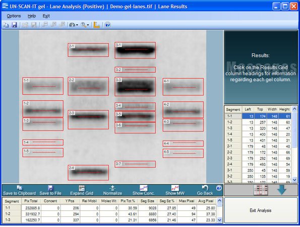 Figure 7. UN­SCAN­IT gel results screen.